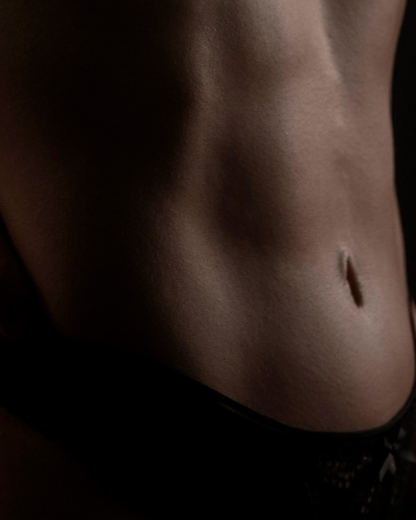 Abdominoplastia com Lipodefinição HD