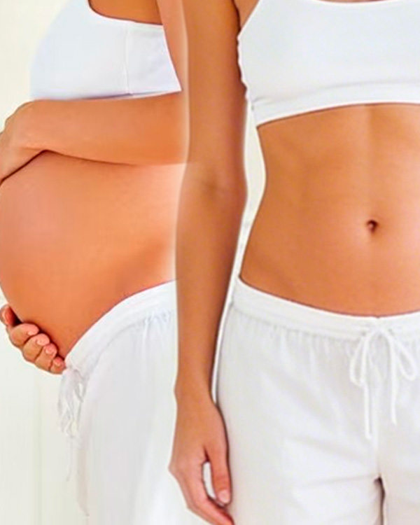 Mommy MakeOver — Transformação da Mamãe